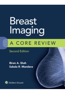 Breast Imaging: A Core Review, 2e