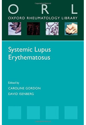 Systemic lupus erythematosus