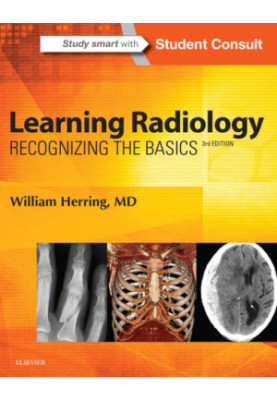 Learning radiology: recognizing the basics