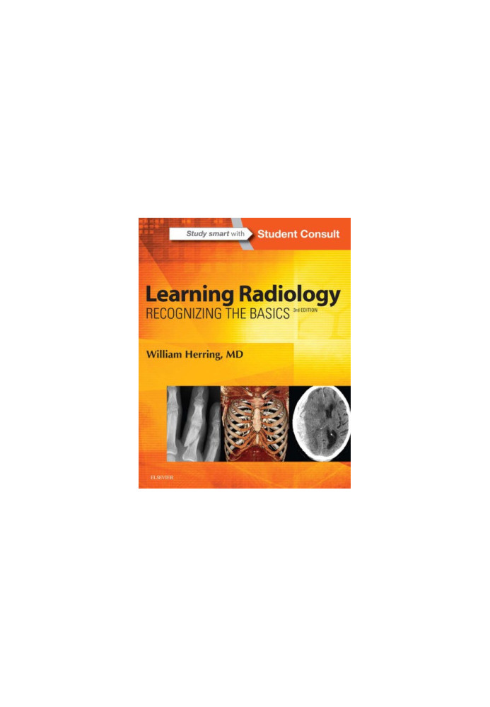 Learning radiology: recognizing the basics