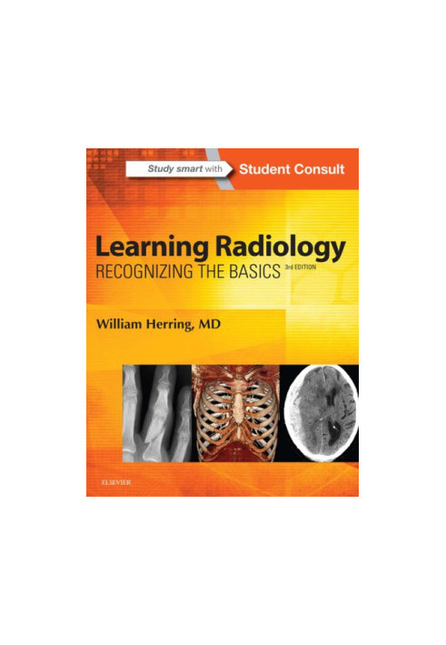 Learning radiology: recognizing the basics