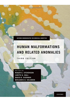 Human malformations and related anomalies