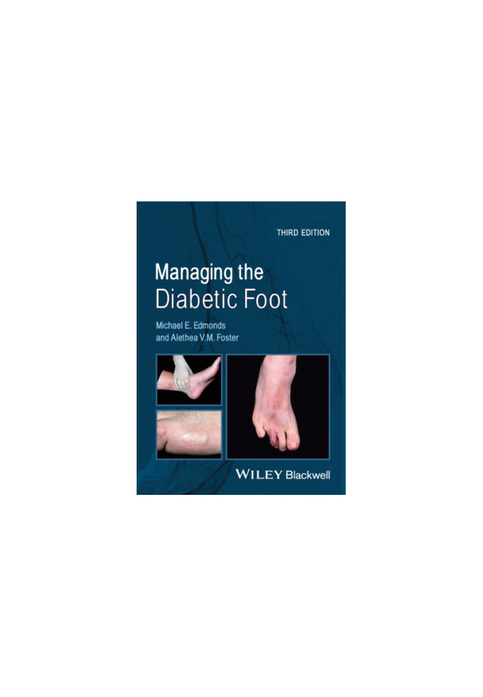 Managing the Diabetic Foot