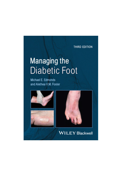 Managing the Diabetic Foot