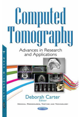 Computed tomography : advances in research and applications