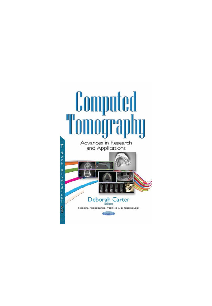 Computed tomography : advances in research and applications