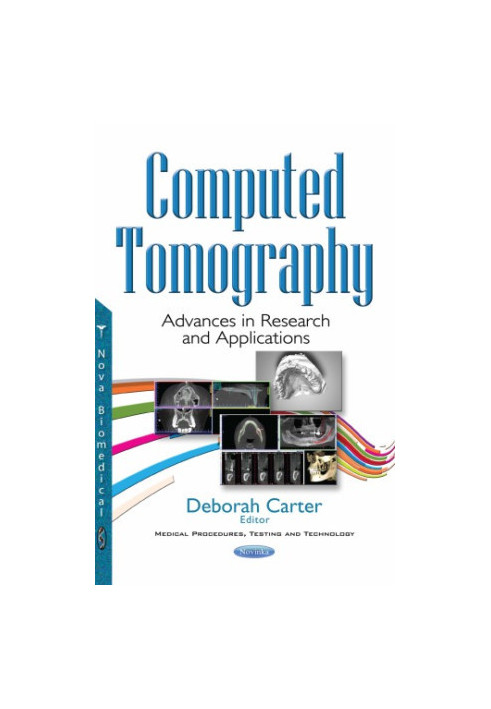 Computed tomography : advances in research and applications