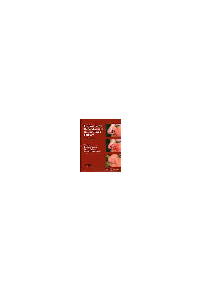Reconstructive conundrums in dermatologic surgery : the nose