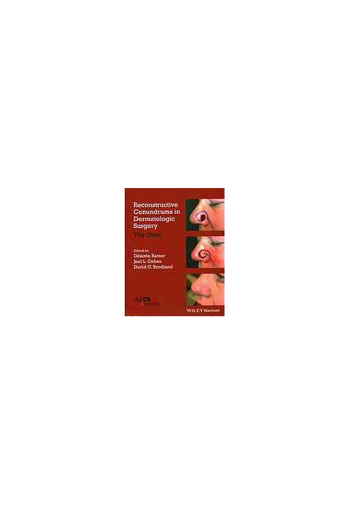 Reconstructive conundrums in dermatologic surgery : the nose