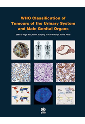 WHO Classification of Tumours of the Urinary System and Male Genital Organs