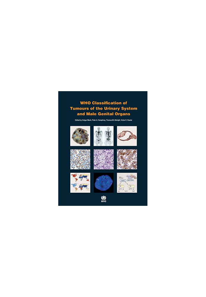 WHO Classification of Tumours of the Urinary System and Male Genital Organs