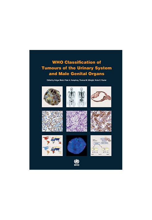 WHO Classification of Tumours of the Urinary System and Male Genital Organs