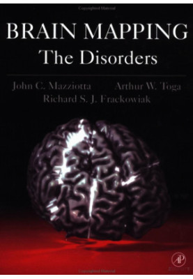 Brain Mapping - The Disorders