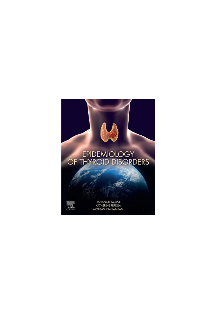 Epidemiology of Thyroid Disorders