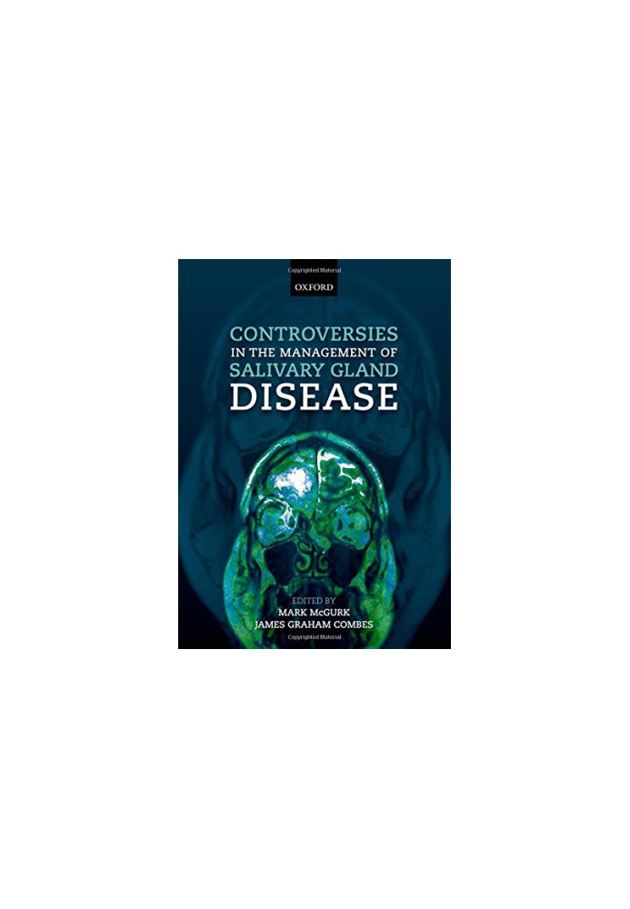 Controversies in the Management of Salivary Gland Disease