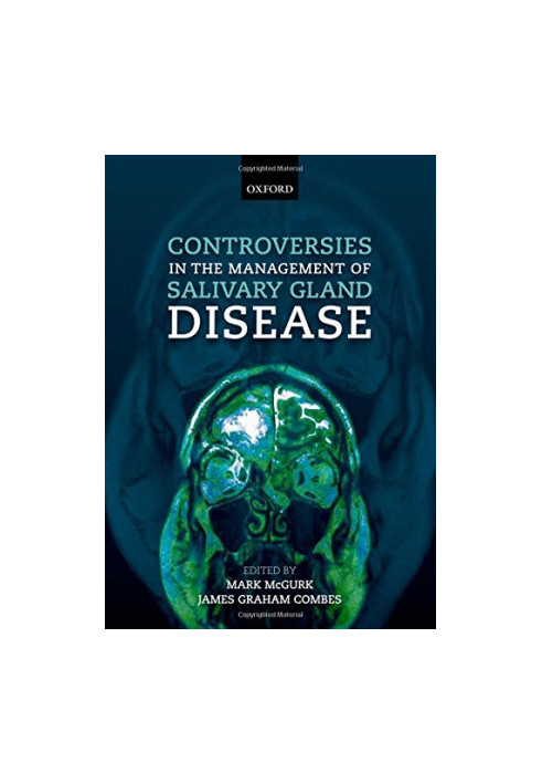 Controversies in the Management of Salivary Gland Disease