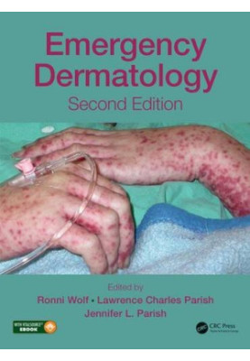 Emergency Dermatology
