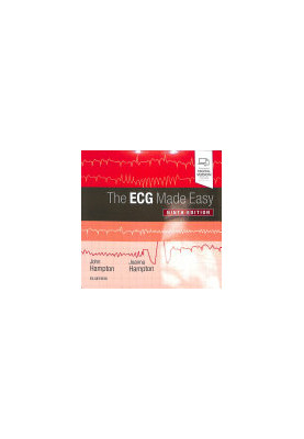 The ECG Made Easy