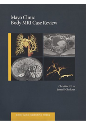 Mayo Clinic body MRI case review