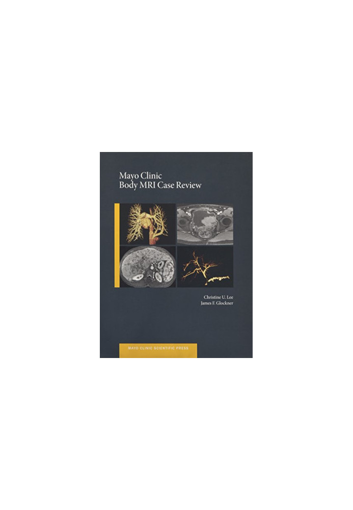 Mayo Clinic body MRI case review