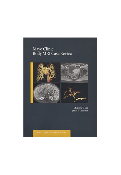 Mayo Clinic body MRI case review