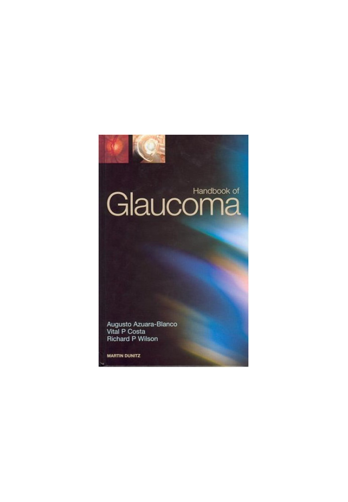Handbook of glaucoma