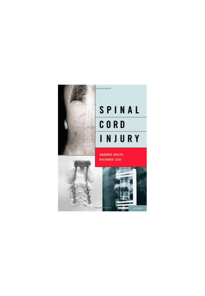 Spinal Cord Injury.