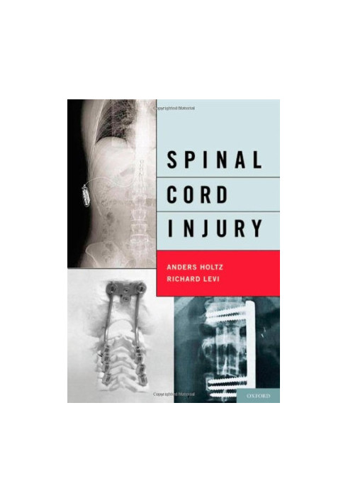 Spinal Cord Injury.
