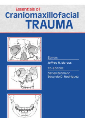 Essentials of Craniomaxillofacial Trauma