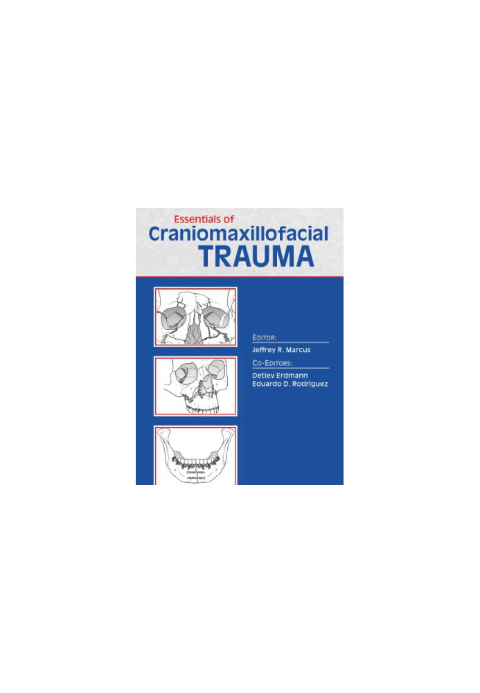 Essentials of Craniomaxillofacial Trauma