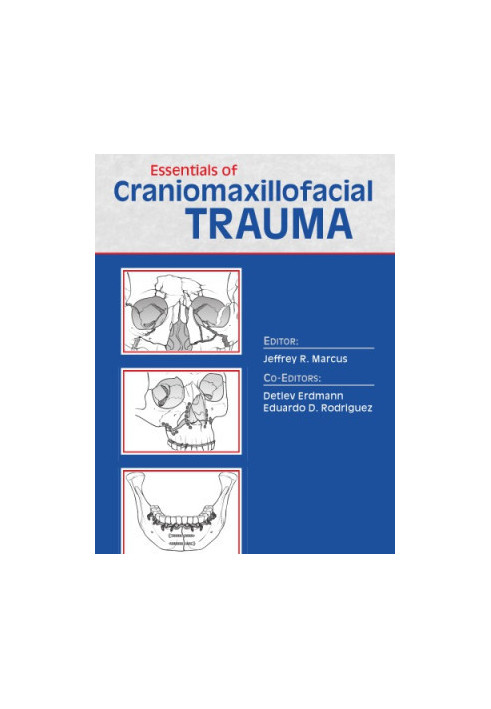 Essentials of Craniomaxillofacial Trauma