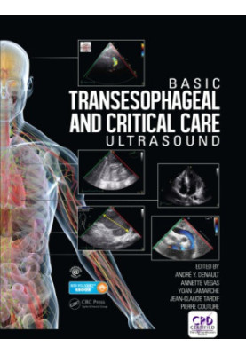 Basic Transesophageal and Critical Care Ultrasound