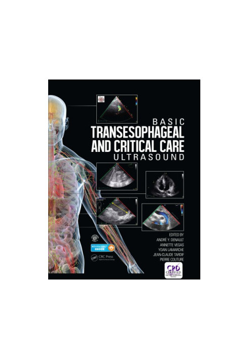 Basic Transesophageal and Critical Care Ultrasound