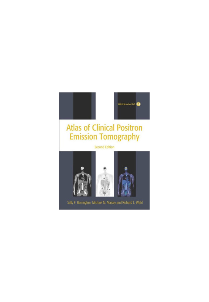 Atlas of Clinical Positron Emission Tomography