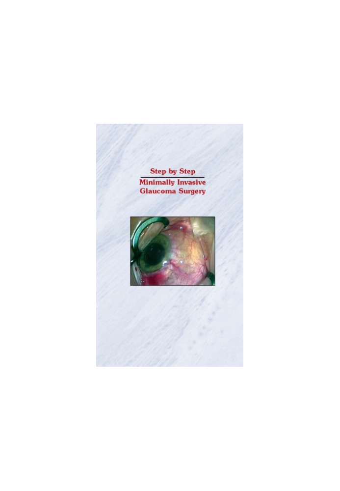 Step by Step Minimally Invasive Glaucoma Surgery