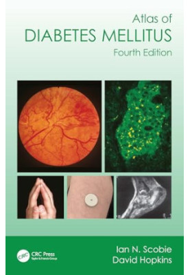 Atlas of Diabetes Mellitus, 4e (Dec 29, 2023)_(1032379456)_(CRC Press)