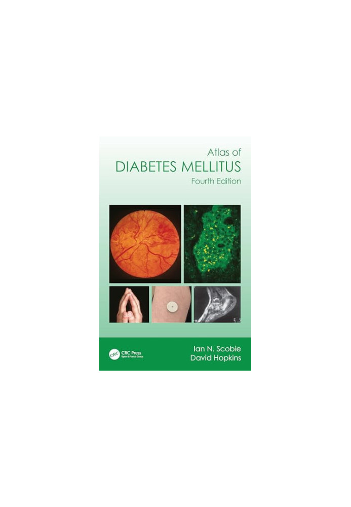 Atlas of Diabetes Mellitus, 4e (Dec 29, 2023)_(1032379456)_(CRC Press)