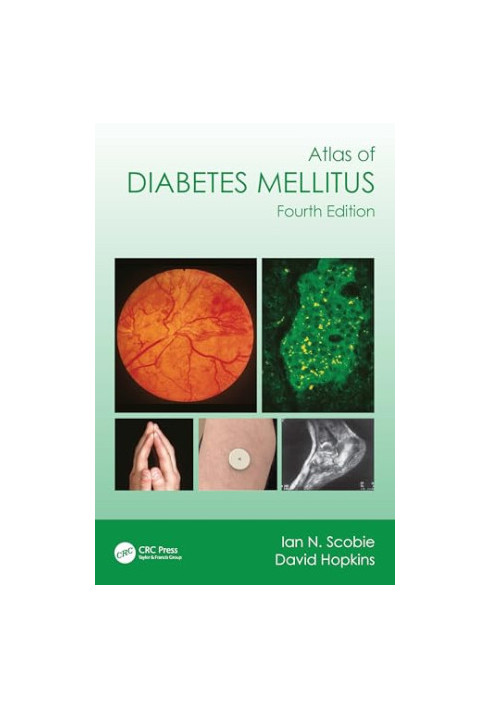 Atlas of Diabetes Mellitus, 4e (Dec 29, 2023)_(1032379456)_(CRC Press)