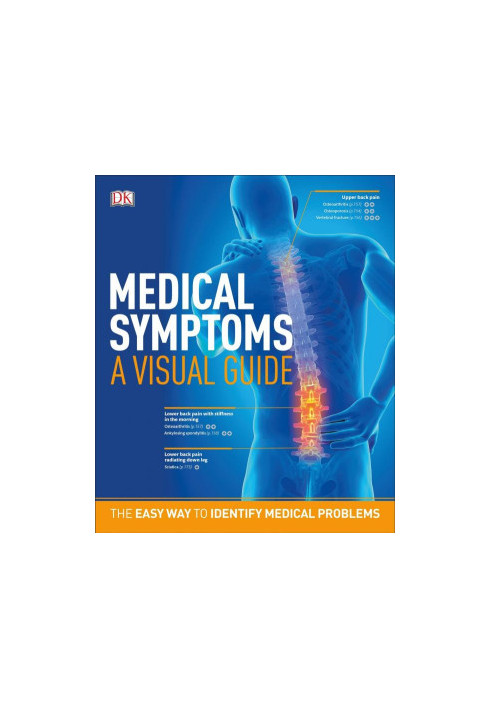 Medical Symptoms a Visual Guide : The Easy Way to Identify Medical Problems