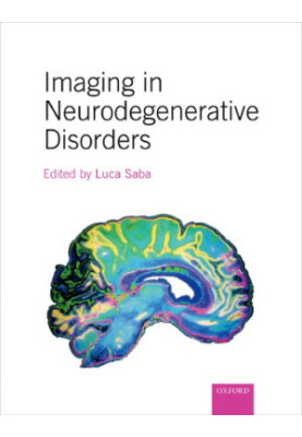 Imaging in neurodegenerative disorders