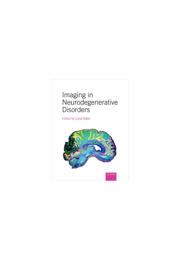 Imaging in neurodegenerative disorders