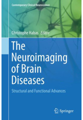 The Neuroimaging of Brain Diseases: Structural and Functional Advances