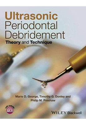 Ultrasonic Periodontal Debridement : Theory and Technique