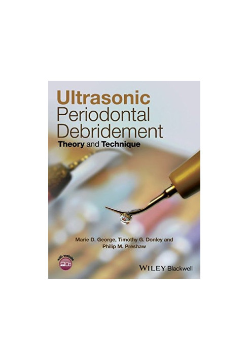 Ultrasonic Periodontal Debridement : Theory and Technique