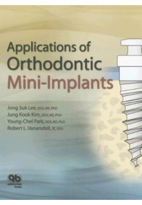 Applications of Orthodontic Mini-Implants.