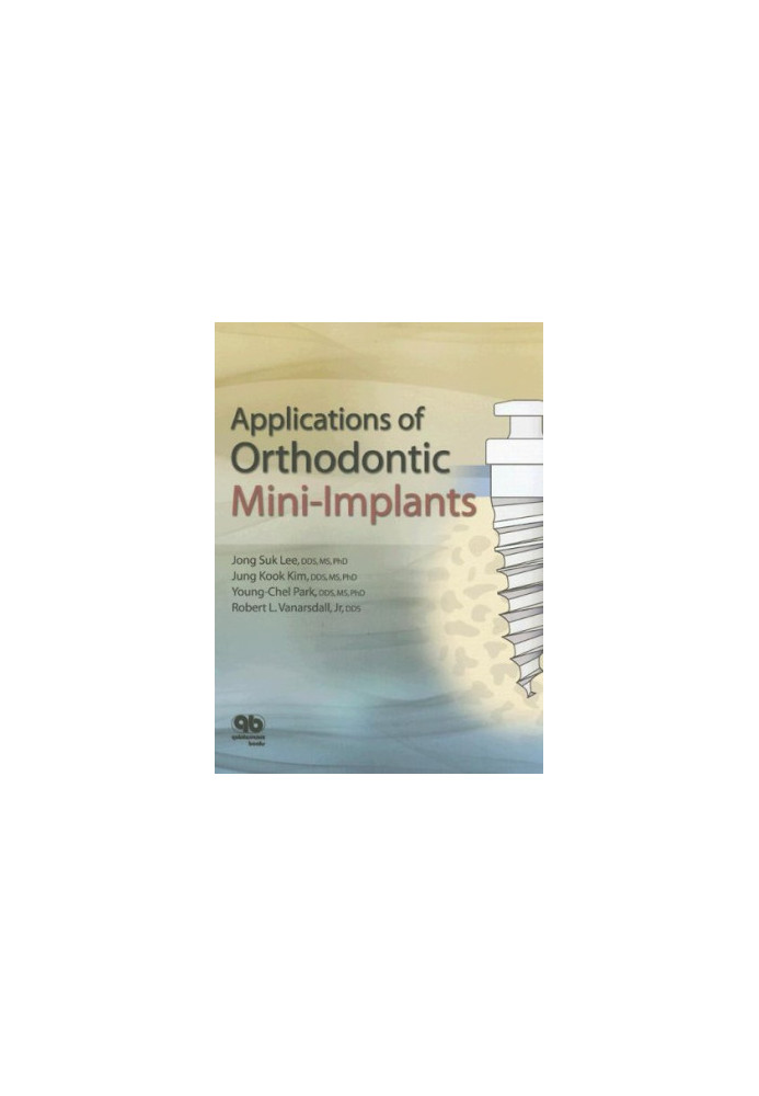 Applications of Orthodontic Mini-Implants.