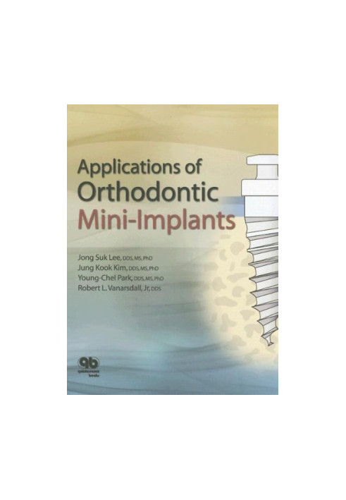Applications of Orthodontic Mini-Implants.