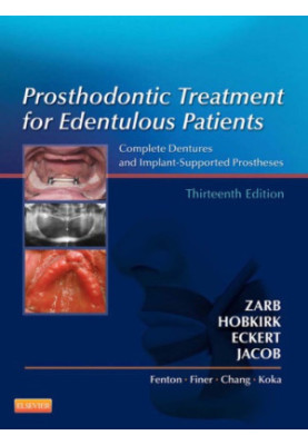 Prosthodontic Treatment for Edentulous Patients: Complete Dentures and Implant-Supported Prostheses