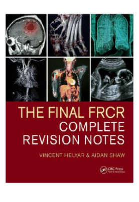The Final FRCR : Complete Revision Notes