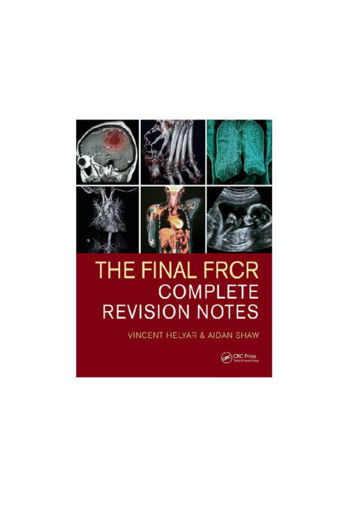 The Final FRCR : Complete Revision Notes